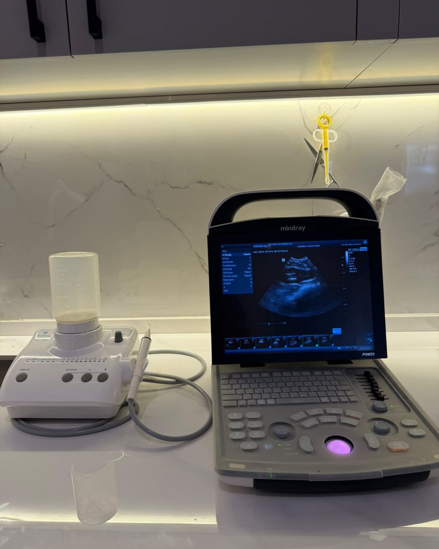Mindray dijital ultrason cihazı ve ultrasonik diş temizleme ünitesi